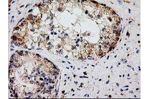 Image no. 8 for anti-Catalase (CAT) antibody (ABIN1497109)