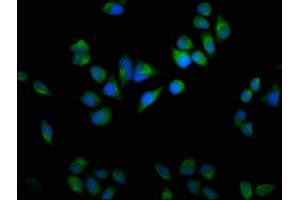 Immunofluorescence staining of Hela cells with ABIN7164629 at 1:100, counter-stained with DAPI. (USP9X anticorps  (C-Term))