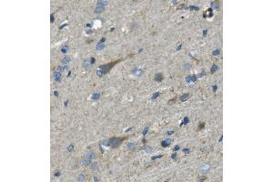 IHC analysis of Nefh using anti-Nefh antibody (ABIN7599700). (NEFH anticorps  (AA 109-466))