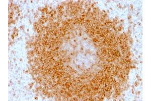 Formalin-fixed, paraffin-embedded human Spleen stained with CD27 Mouse Monoclonal Antibody (LPFS2/1611).