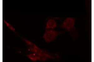 anti-Capping Protein (Actin Filament), Gelsolin-Like (CAPG) (Internal Region) antibody