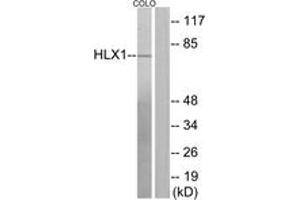Western blot analysis of extracts from COLO205 cells, using HLX1 Antibody. (HLX anticorps  (AA 321-370))