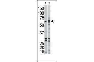 The anti-ACVR1B Pab (ABIN392232 and ABIN2841926) is used in Western blot to detect ACVR1B in Jurkat (1) and mouse kidney (2) tissue lysates.