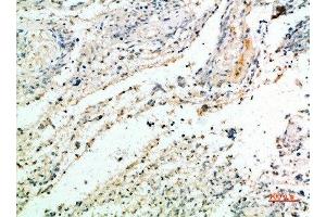 Immunohistochemical analysis of paraffin-embedded human-brain, antibody was diluted at 1:200 (Versican anticorps  (AA 2530-2580))