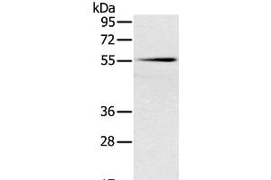 Western Blot analysis of Mouse pancreas tissue using SLC16A10 Polyclonal Antibody at dilution of 1:200 (SLC16A10 anticorps)