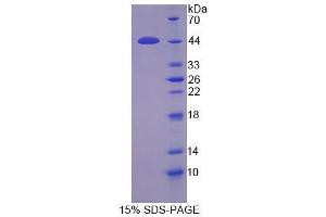 Image no. 1 for Protease, Serine, 23 (PRSS23) (AA 20-383) protein (His tag) (ABIN3209976)