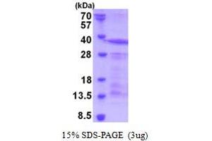 SDS-PAGE (SDS) image for Sialophorin (SPN) (AA 20-253) protein (His tag) (ABIN5853218)