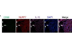 NLRP7 is predominantly expressed in decidual M2 macrophages (CD68+/IL-10+) in the human endometrium of the pregnant uterus. (IL-10 anticorps  (AA 101-178))