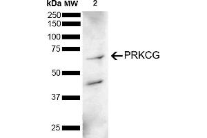 Western blot analysis of Mouse Brain showing detection of 78 kDa PRKCG protein using Rabbit Anti-PRKCG Polyclonal Antibody (ABIN5695970). (PKC gamma anticorps  (AA 150-250) (HRP))