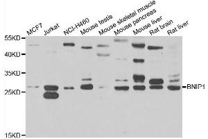 Western blot analysis of extracts of various cell lines, using BNIP1 antibody. (BNIP1 anticorps)