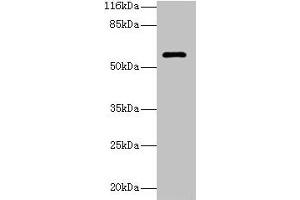 Western blot All lanes: GK3P antibody at 2 μg/mL + Hela whole cell lysate Secondary Goat polyclonal to rabbit IgG at 1/10000 dilution Predicted band size: 61 kDa Observed band size: 61 kDa (GK3P anticorps  (AA 1-220))