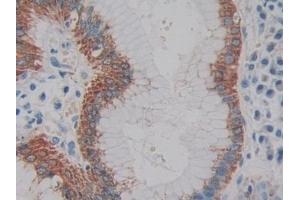 Detection of IL2 in Human Stomach Tissue using Monoclonal Antibody to Interleukin 2 (IL2) (IL-2 anticorps  (AA 21-153))