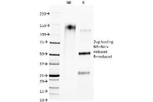SDS-PAGE Analysis of Purified CTLA4 Mouse Monoclonal Antibody (L4P2F5. (CTLA4 anticorps)