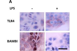 Functional activation of the LPS/TLR4 axis mediates BAMBI downregulation. (BAMBI anticorps  (AA 101-200))