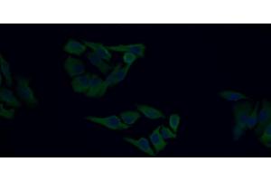 Detection of IGF1 in Human HepG2 cell using Monoclonal Antibody to Insulin Like Growth Factor 1 (IGF1)