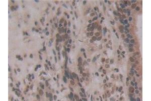 anti-Ectonucleotide Pyrophosphatase / phosphodiesterase 2 (ENPP2) (AA 637-905) antibody
