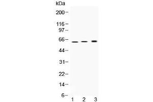 Western blot testing of 1) rat stomach, 2) mouse stomach and 3) human SGC-7901 (human gastric cancer) lysate with ATP4B antibody at 0.