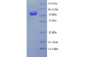 SDS-PAGE (SDS) image for Ubiquitin-Conjugating Enzyme E2Q Family Member 2 (UBE2Q2) (AA 1-375), (full length) protein (His-SUMO Tag) (ABIN5711630)