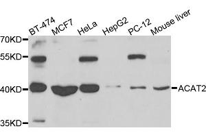 Western blot analysis of extracts of various cell lines, using ACAT2 antibody (ABIN5975212) at 1/1000 dilution. (ACAT2 anticorps)