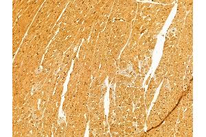 ABIN6263423 and ABIN6273058 at 1/100 staining Rat heart tissue by IHC-P. (MTO1 anticorps  (N-Term))