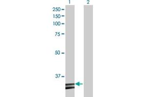 Western Blot analysis of HADH expression in transfected 293T cell line by HADH MaxPab polyclonal antibody. (HADH anticorps  (AA 1-314))