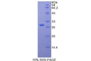 SDS-PAGE (SDS) image for Protease, serine, 8 (PRSS8) (AA 33-218) protein (His tag) (ABIN1877304)