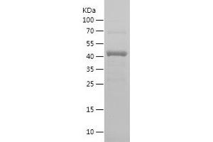Western Blotting (WB) image for Methyltransferase Like 3 (METTL3) (AA 397-580) protein (His-IF2DI Tag) (ABIN7123947)