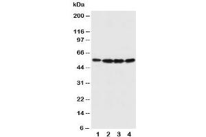 Western blot testing of Fascin antibody and Lane 1:  U87 (Fascin anticorps  (N-Term))