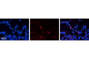 Rabbit Anti-FCGRT Antibody     Formalin Fixed Paraffin Embedded Tissue: Human Lung Tissue  Observed Staining: Membrane and cytoplasmic in alveolar type I cells  Primary Antibody Concentration: 1:100  Other Working Concentrations: 1/600  Secondary Antibody: Donkey anti-Rabbit-Cy3  Secondary Antibody Concentration: 1:200  Magnification: 20X  Exposure Time: 0. (FcRn anticorps  (N-Term))