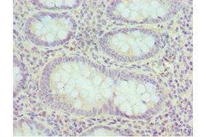 Immunohistochemistry of paraffin-embedded human epityphlon tissue using ABIN7152160 at dilution of 1:100