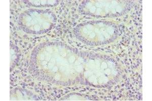 Immunohistochemistry of paraffin-embedded human epityphlon tissue using ABIN7152160 at dilution of 1:100 (EIF3H anticorps  (AA 80-340))