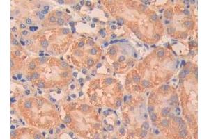 Detection of CA5B in Mouse Kidney Tissue using Polyclonal Antibody to Carbonic Anhydrase VB, Mitochondrial (CA5B)