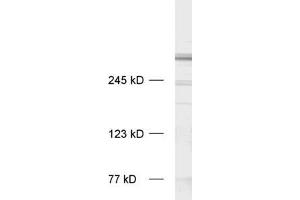 dilution: 1 : 1000, sample: rat brain homogenate (MAP2 anticorps  (AA 2-309))