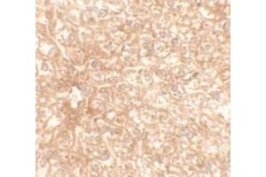Immunohistochemical analysis of RAPGEF4 in mouse liver tissue with RAPGEF4 polyclonal antibody  at 2. (RAPGEF4 anticorps  (N-Term))