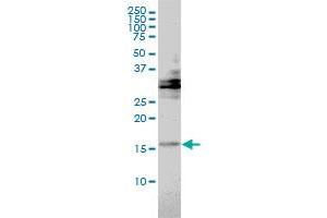 TRAPPC2 monoclonal antibody (M01), clone 2E10 Western Blot analysis of TRAPPC2 expression in Hela . (TRAPPC2 anticorps  (AA 1-140))