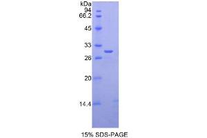 SDS-PAGE analysis of Human GLI3 Protein. (GLI Family Zinc Finger Protein 3 Protéine)