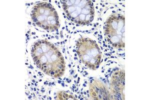 Immunohistochemistry of paraffin-embedded human colon using GTF2F2 antibody (ABIN6131726, ABIN6141494, ABIN6141496 and ABIN6217519) at dilution of 1:200 (40x lens).