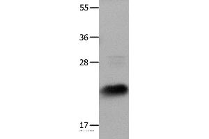 Western blot analysis of Hela cells, using IL18 Polyclonal Antibody at dilution of 1:1350 (IL-18 anticorps)
