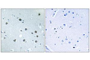 Immunohistochemistry analysis of paraffin-embedded human brain tissue using MYO1D antibody. (Myosin ID anticorps  (C-Term))