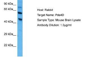 Host: Rabbit Target Name: PDE4D Sample Tissue: Mouse Brain Antibody Dilution: 1ug/ml