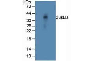 Detection of NOTCH4 in Rat Vein Tissue using Polyclonal Antibody to Notch Homolog 4 (NOTCH4) (NOTCH4 anticorps  (AA 1715-2001))