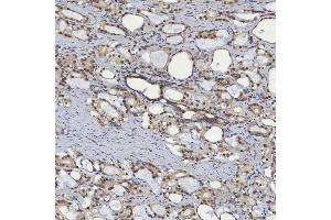 IHC analysis of mSin3A/SIN3A using anti-mSin3A/SIN3A antibody (ABIN7602504). (SIN3A anticorps  (AA 8-918))