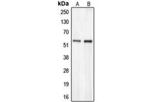 Western blot analysis of CHST2 expression in HepG2 (A), COLO205 (B) whole cell lysates. (CHST2 anticorps  (N-Term))