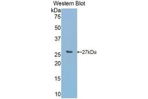 Detection of recombinant CA5A using Polyclonal Antibody to Carbonic Anhydrase VA (CA5A) (CA5A anticorps  (AA 12-219))