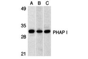 Western Blotting (WB) image for anti-PHAP I (C-Term) antibody (ABIN1030579) (PHAP I anticorps  (C-Term))