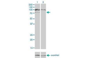 Western blot analysis of HGS over-expressed 293 cell line, cotransfected with HGS Validated Chimera RNAi (Lane 2) or non-transfected control (Lane 1). (HGS anticorps  (AA 513-612))
