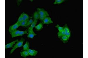 Immunofluorescent analysis of Hela cells using ABIN7152013 at dilution of 1:100 and Alexa Fluor 488-congugated AffiniPure Goat Anti-Rabbit IgG(H+L)