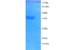 Cytochrome C Oxidase Subunit Vb (COX5B) (AA 32-129), (full length) protein (GST tag)