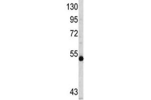 Western blot analysis of MYCN antibody and CEM lysate