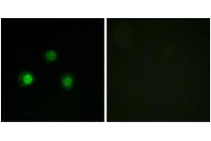 Immunofluorescence analysis of HuvEc cells, using MSH2 Antibody. (MSH2 anticorps  (AA 541-590))